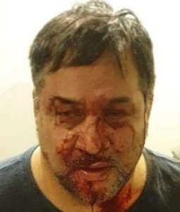 Vicious assault in Flat Bush