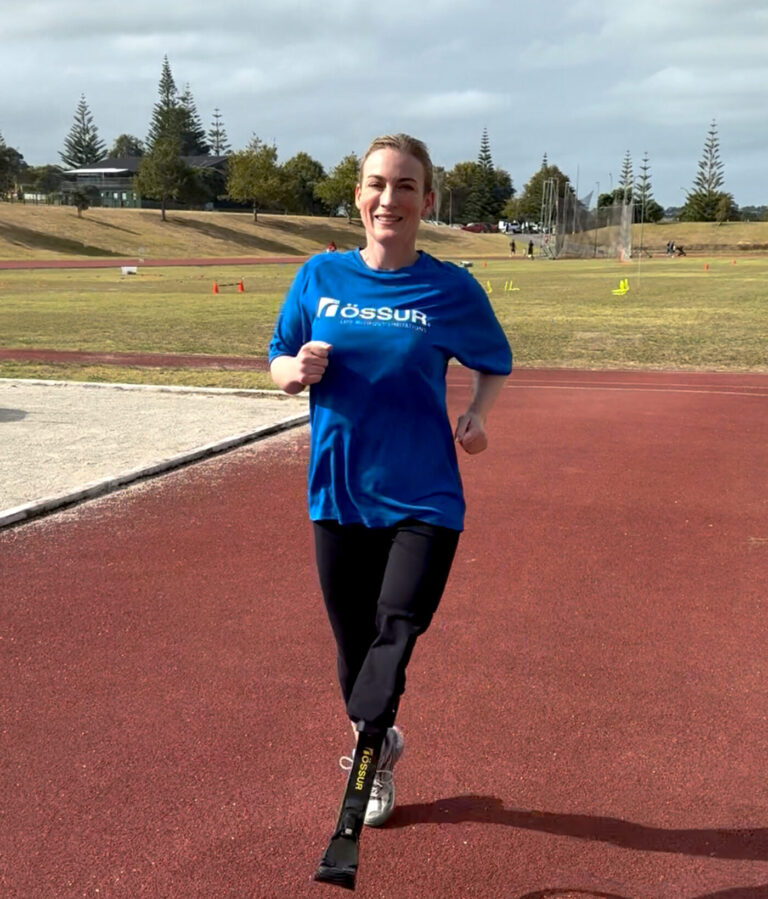 Fighting to improve amputee funding